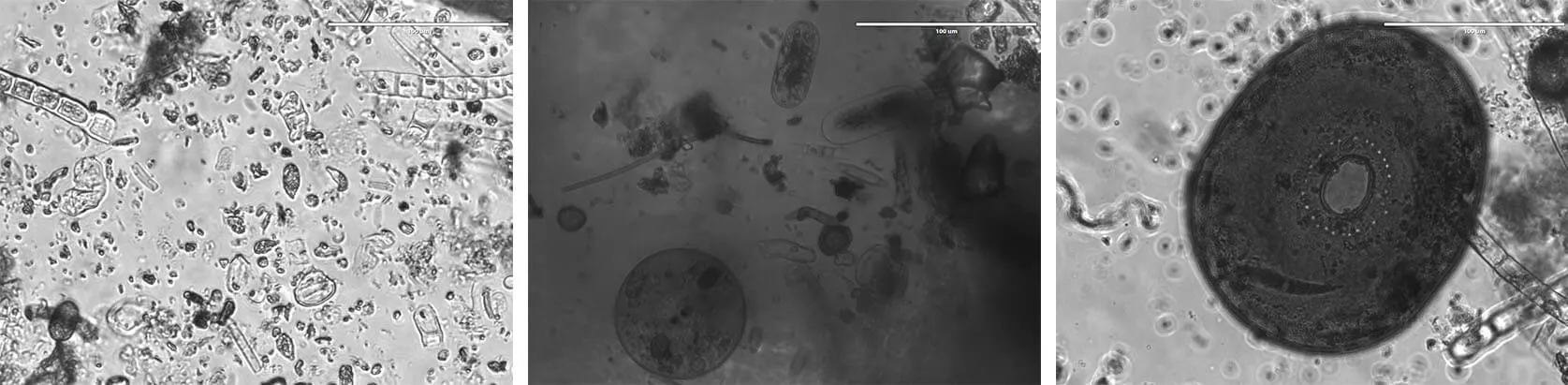 Microscopic Life in Water Samples: bacteria, plant cells, protozoa and microscopic animals mixing, procreating and thriving off of each other’s life and death, Slåttmossen Nature Reserve, 2021.
